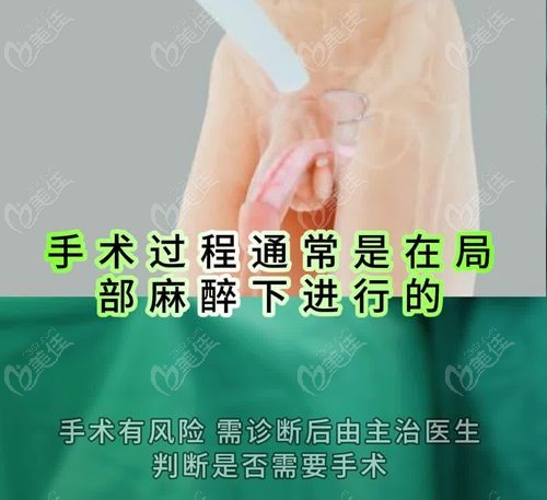 男性生物补片增粗能维持8-15年