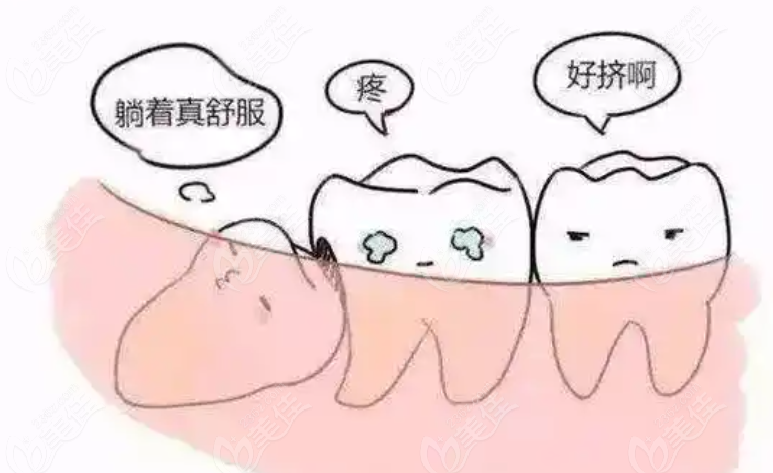 拔智齒