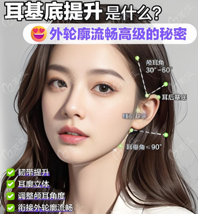 注射耳基底提升是什么