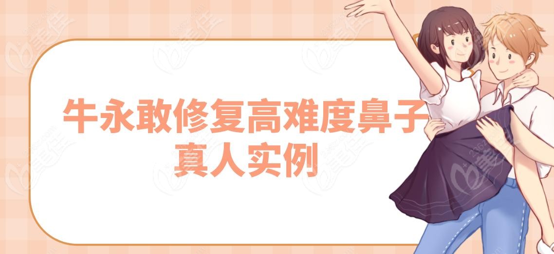 .牛永敢修復高難度鼻子真人實例