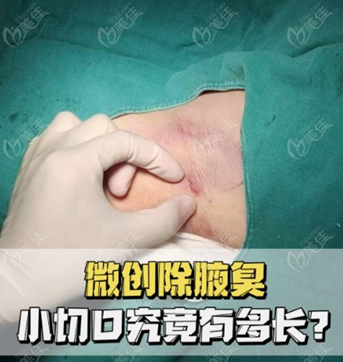 成都腋臭医院前十名