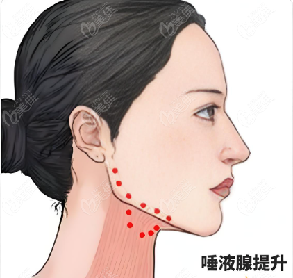 李俊霞面部輪廓注射