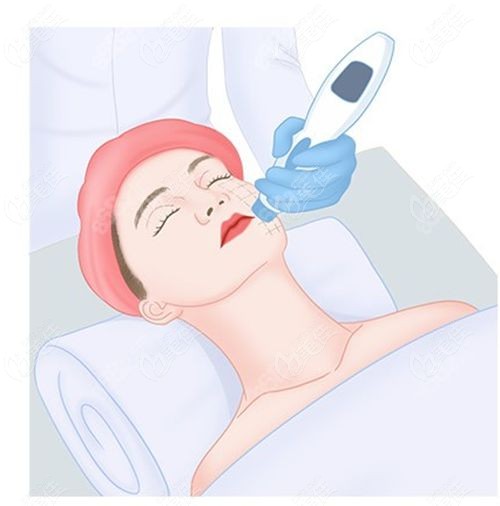 钻石超塑溶脂不是持久的