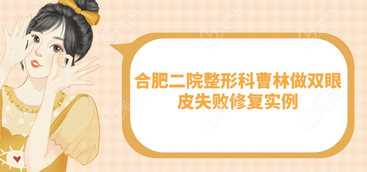 合肥二院整形科曹林做双眼皮失败修复实例