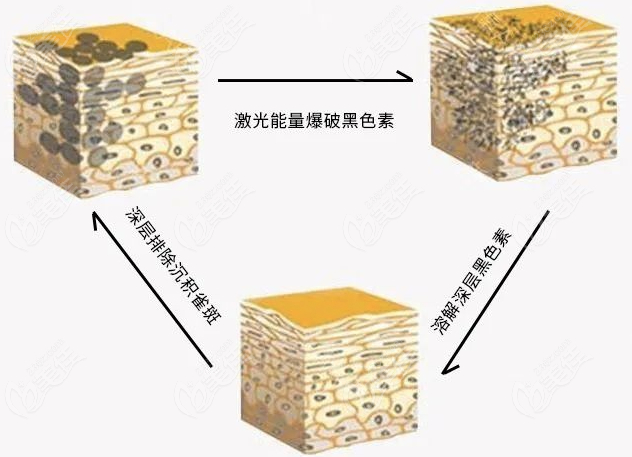 重庆皮秒祛斑热门医院盘点 重庆皮秒祛斑热门医院盘点