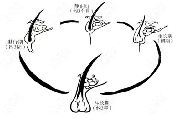 海南激光脱毛价格多少钱