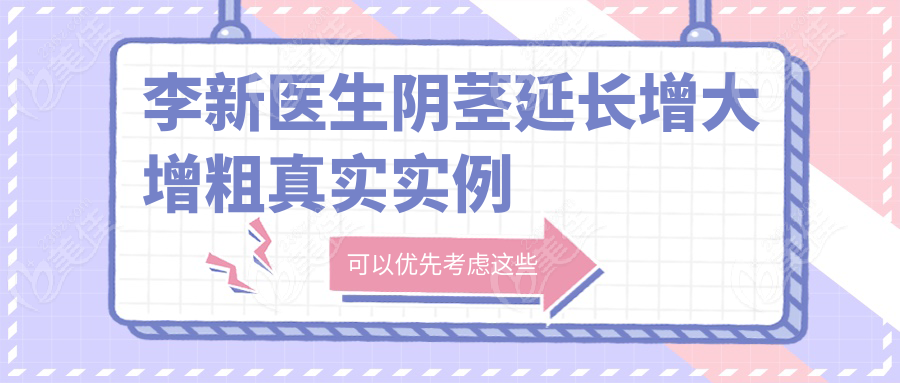 李新医生阴茎延长增大增粗真实实例