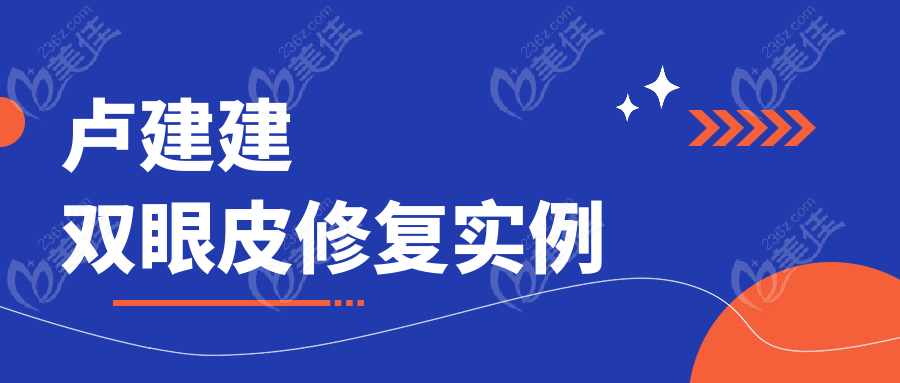 卢建建双眼皮修复实例