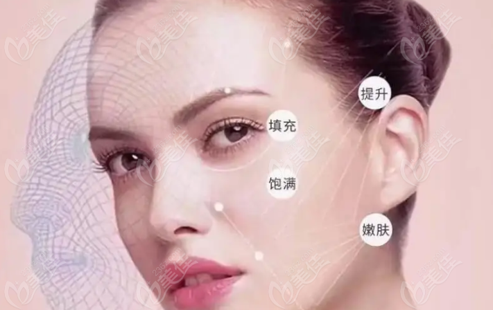 面部提升