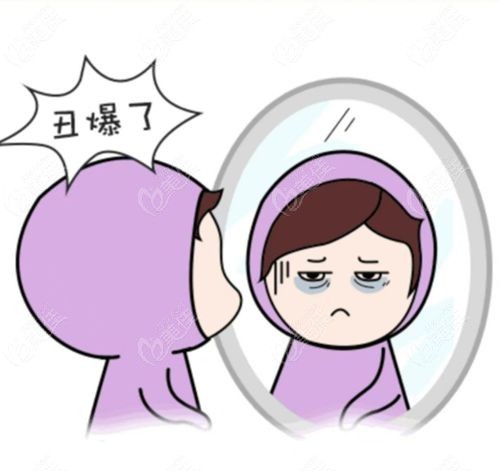 贺洁眼外翻一般要多少钱