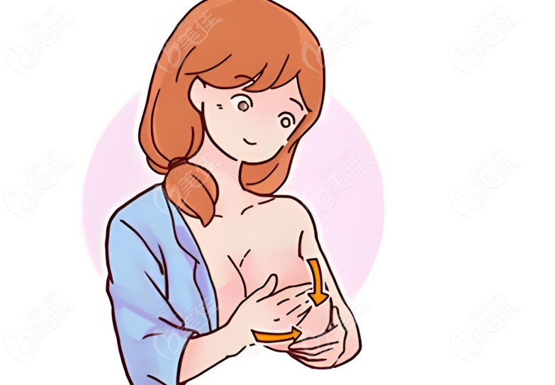 乳房悬吊手术