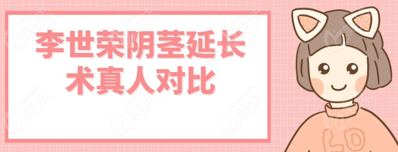 李世荣阴茎延长术真人对比