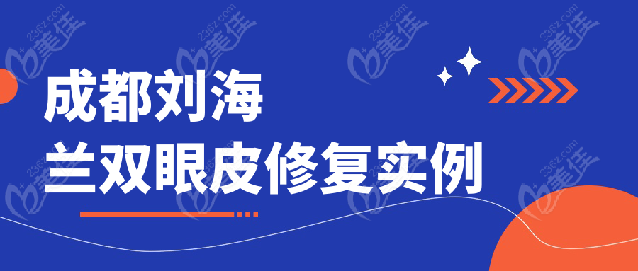 成都劉海蘭雙眼皮修復(fù)實(shí)例