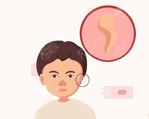郭树忠耳再造价格表
