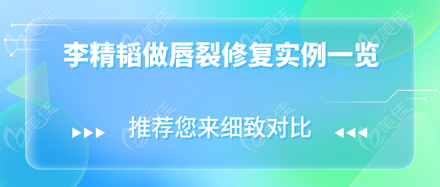 李精韬做唇裂修复实例一览