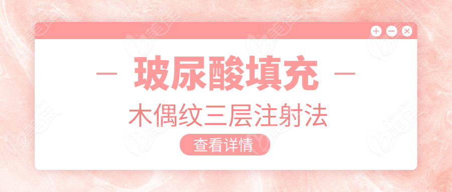 玻尿酸填充木偶紋三層注射法