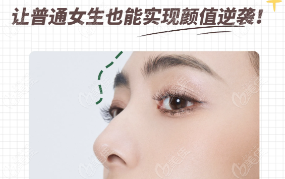 伊妍仕少女針