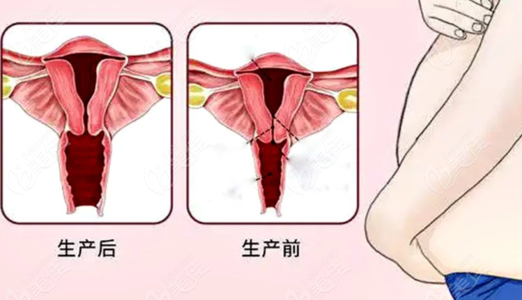 華西私密整形那個醫(yī)生好