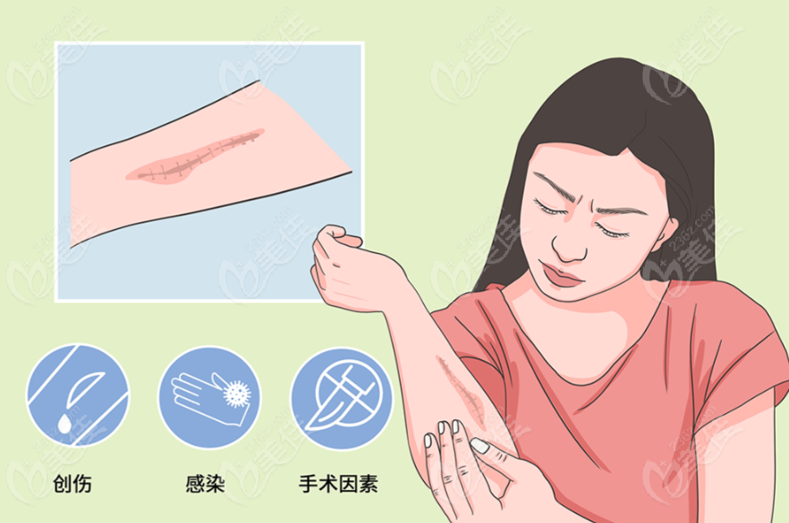 西安疤痕修复哪家医院好口碑榜
