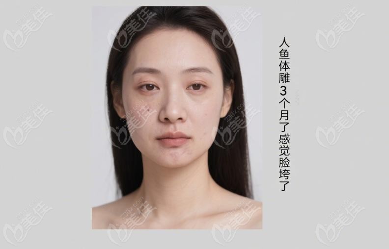 人魚體雕3個月了感覺臉垮了 人魚體雕3個月了感覺臉垮了