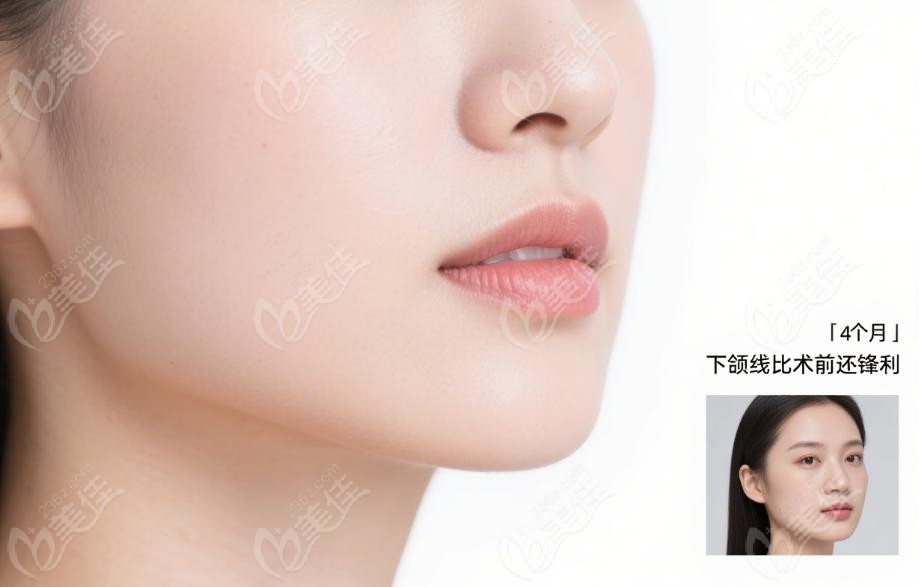 第 4 個月逆襲的實操攻略:3 步皮膚 “自愈力” 第 4 個月逆襲的實操攻略:3 步皮膚 “自愈力”