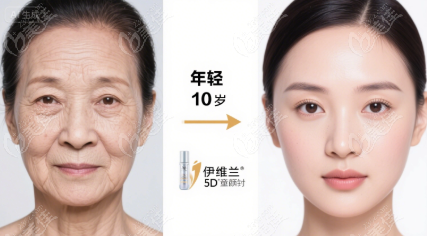 伊维兰5D童颜针的"型号"