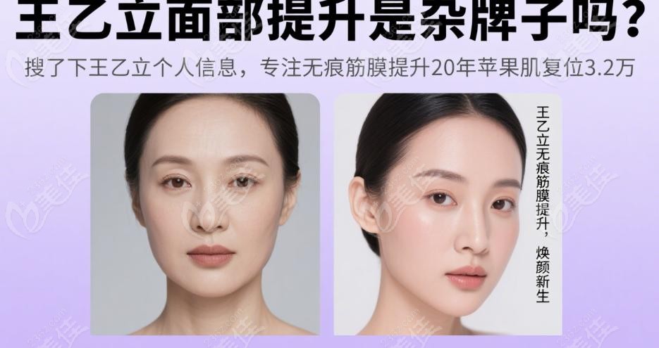 深圳王乙立專注無痕筋膜提升20年