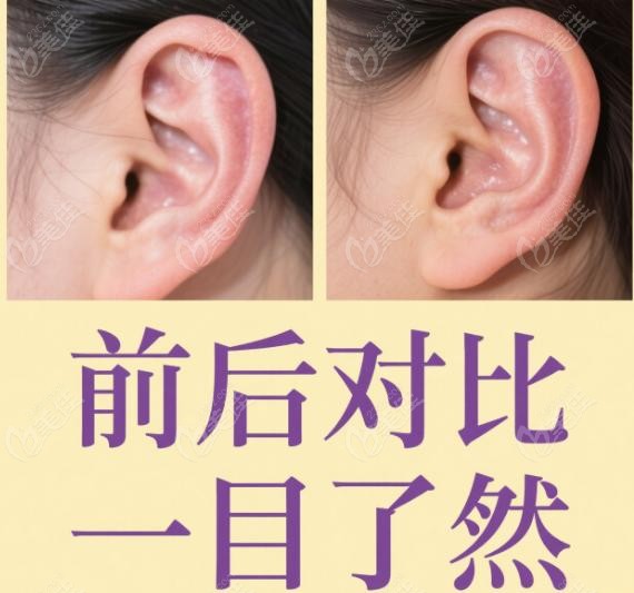 郭树忠耳再造排名第几