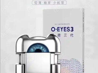歐晴自鎖托槽
