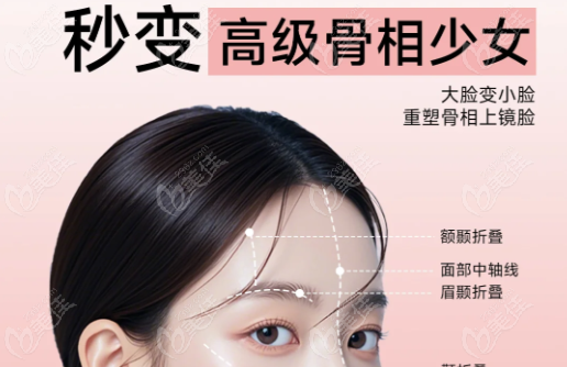 pst 面部提升术
