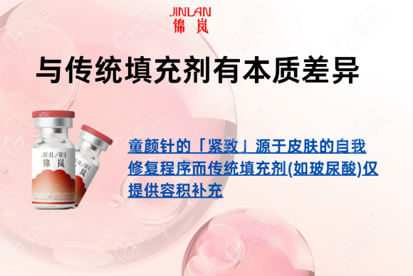 锦岚超凡童颜针