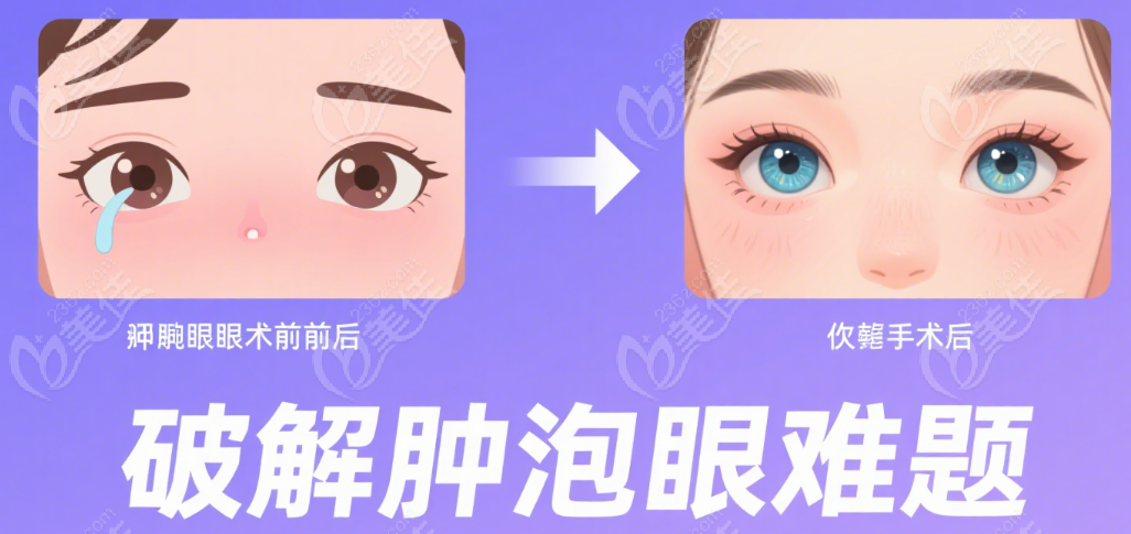 上海安禾美阁郑小红眼综合|眼修复技术 