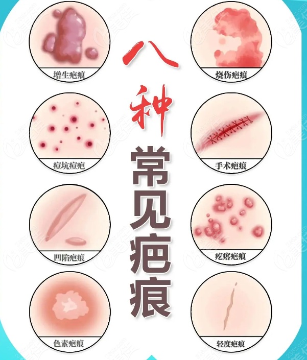 攀枝花祛疤好的醫(yī)院排名前十