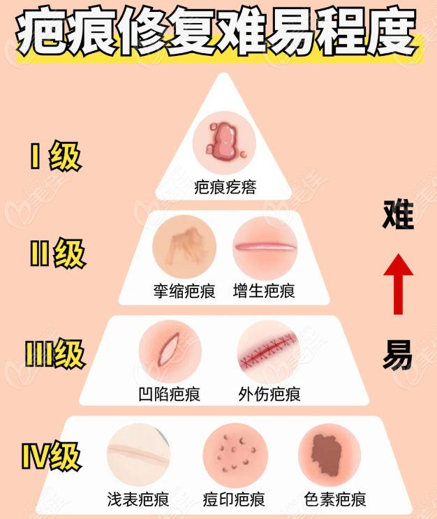 攀枝花疤痕修復(fù)醫(yī)院排名