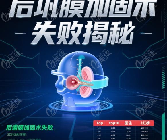 后巩膜加固术医生十大排名