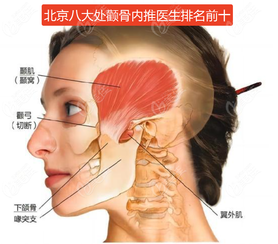 北京八大处颧骨内推医生排名前十