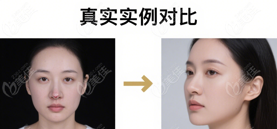 鄭州胡志成一體式鼻基底實(shí)例