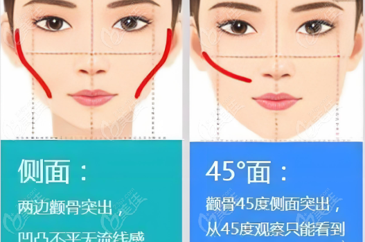 想在八大处做颧骨内推得怎么准备www.236z.com