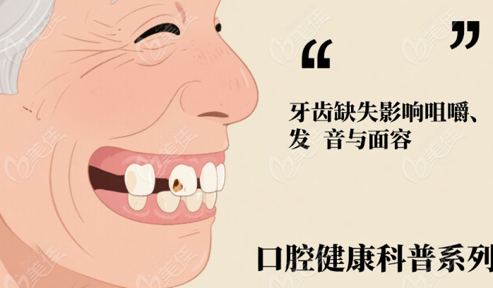 70歲老人只剩四顆牙建議做假牙嗎236z.com