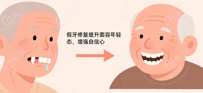 70歲老人假牙安裝