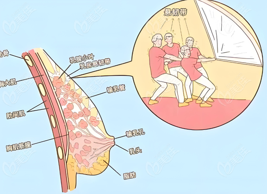 段国新医生做乳房下垂悬吊提升手术技术怎么样？