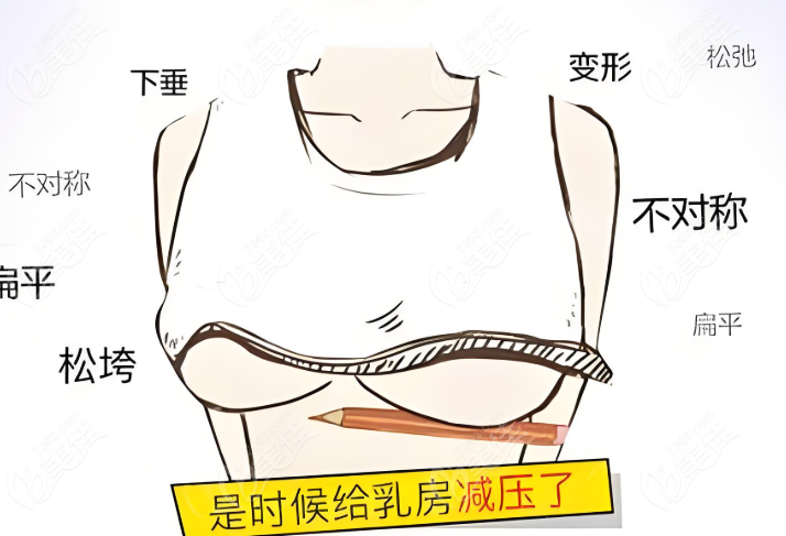 段国新医生胸部整形预约挂号常见问题解答