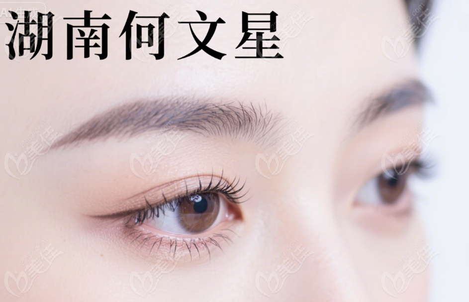 湖南何文星修复眼睛后的真实反馈