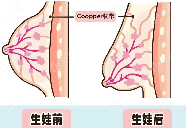 段国新医生悬吊手术有没有失败实例
