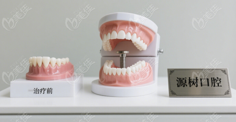 桂林源樹(shù)口腔價(jià)格