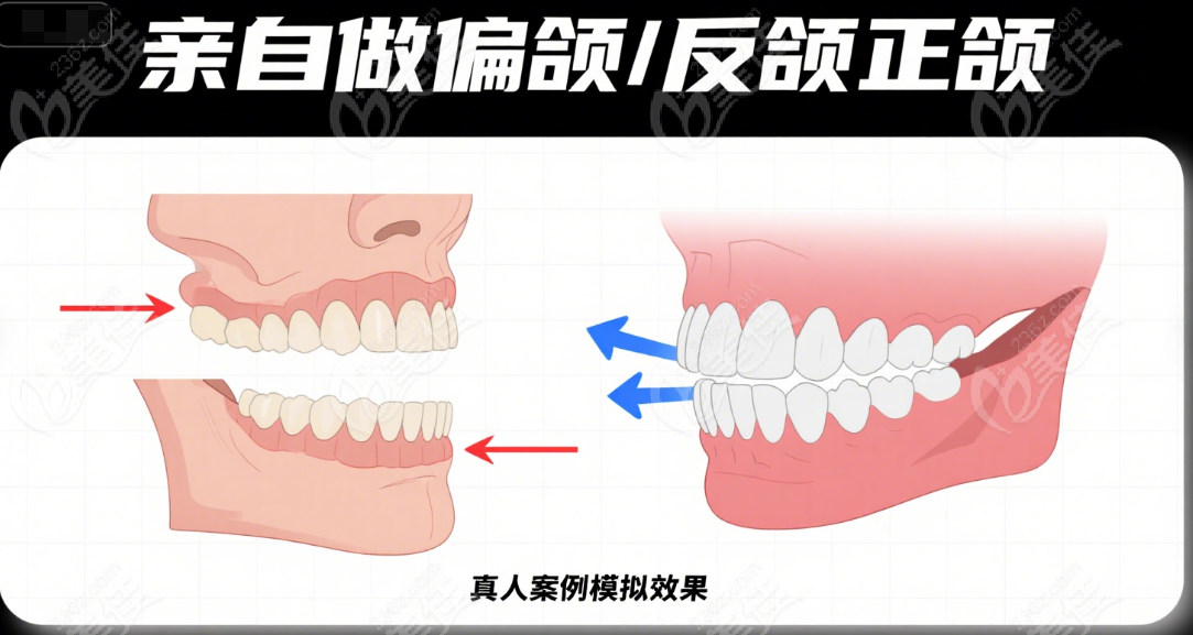 羅恩手術(shù)親自做