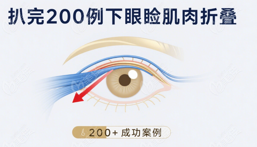 談?dòng)铗v修復(fù)下瞼外翻200例實(shí)例解析