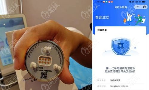 超聲炮到底是不是“智商稅