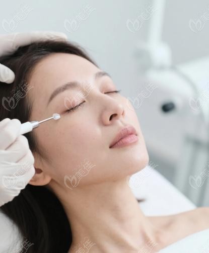 上海整形杜園園修復(fù)臥蠶核心技術(shù)