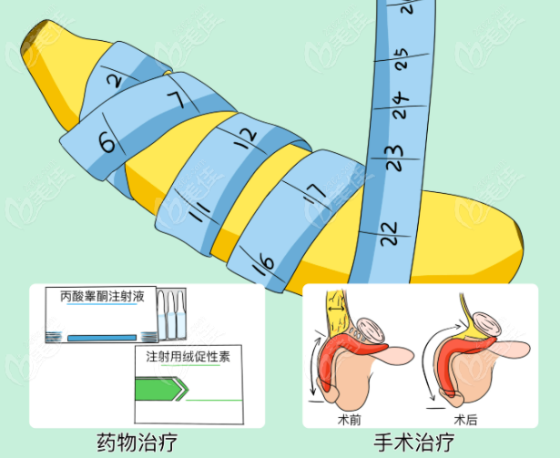 李世荣阴茎延长术背景与患者情况